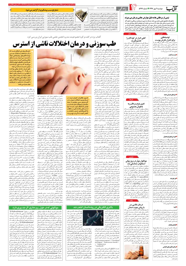 روزنامه آفتاب یزد — طب سوزنی و درمان اختلالات ناشی از استرس